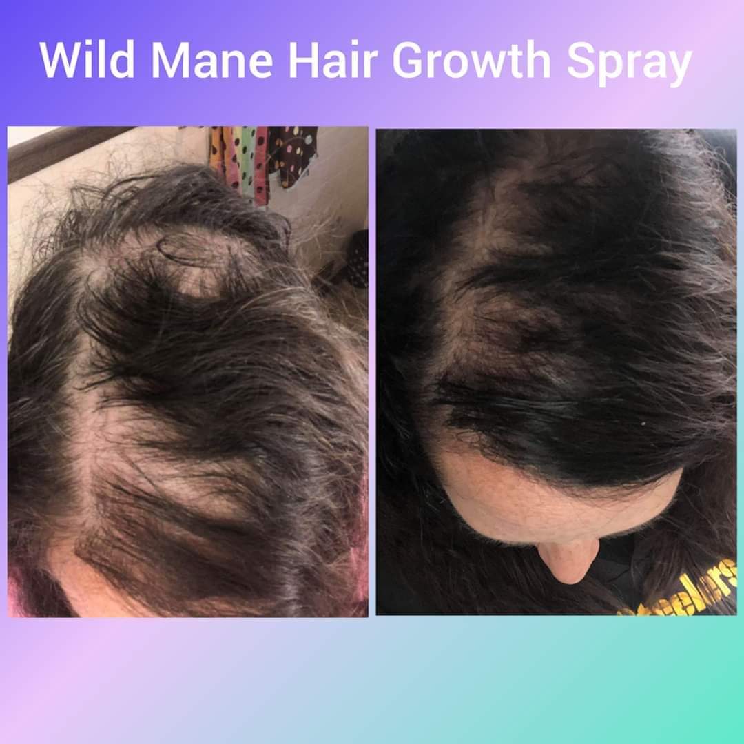 Wild Mane Hair Growth Spray